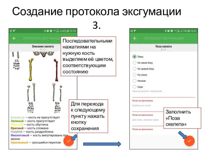 Создание протокола эксгумации 3. Последовательными нажатиями на нужную кость выделяем её