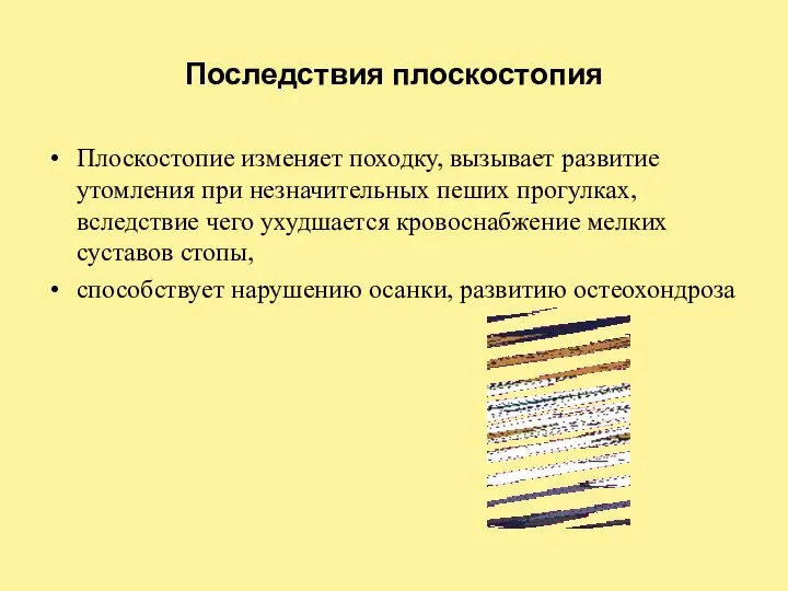 Последствия плоскостопия Плоскостопие изменяет походку, вызывает развитие утомления при незначительных пеших