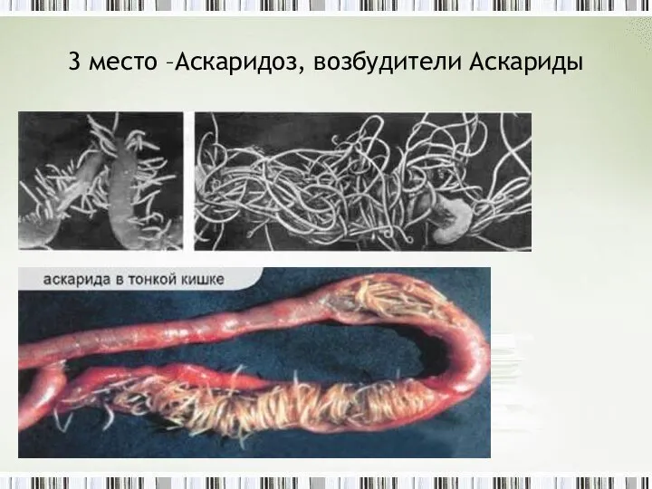 3 место –Аскаридоз, возбудители Аскариды