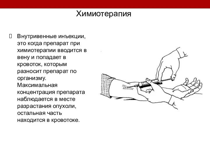 Химиотерапия Внутривенные инъекции, это когда препарат при химиотерапии вводится в вену