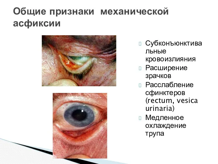 Общие признаки механической асфиксии Субконъюнктивальные кровоизлияния Расширение зрачков Расслабление сфинктеров (rectum, vesica urinaria) Медленное охлаждение трупа