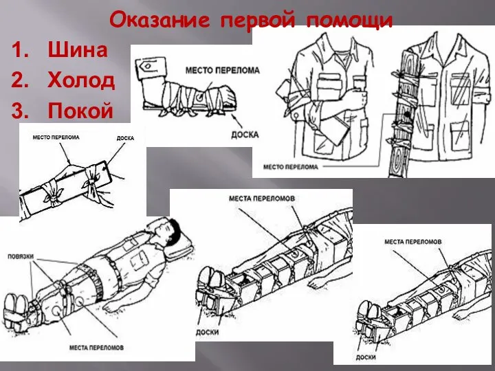 Оказание первой помощи Шина Холод Покой