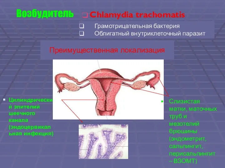 Цилиндрический эпителий шеечного канала (эндоцервикальная инфекция) Слизистая матки, маточных труб и