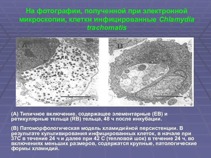 На фотографии, полученной при электронной микроскопии, клетки инфицированные Chlamydia trachomatis (А)