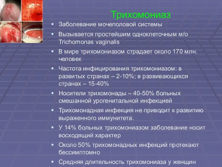 Трихомониаз Заболевание мочеполовой системы Вызывается простейшим одноклеточным м/о Trichomonas vaginalis В