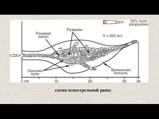 схема огнестрельной раны