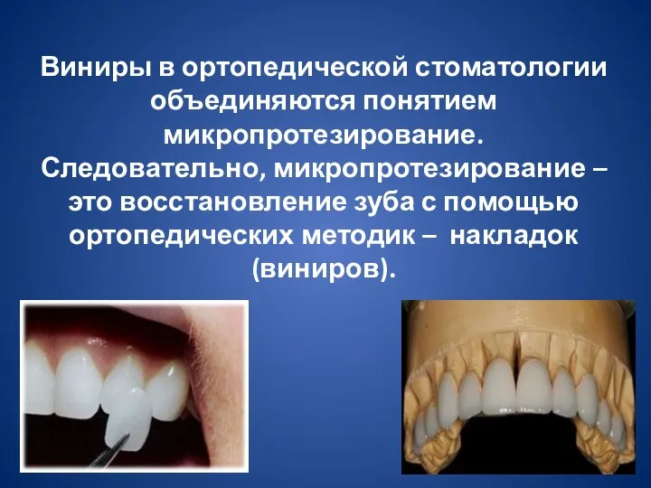 Виниры в ортопедической стоматологии объединяются понятием микропротезирование. Следовательно, микропротезирование – это