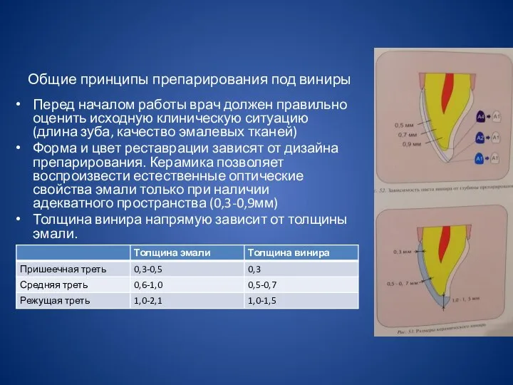 Общие принципы препарирования под виниры Перед началом работы врач должен правильно