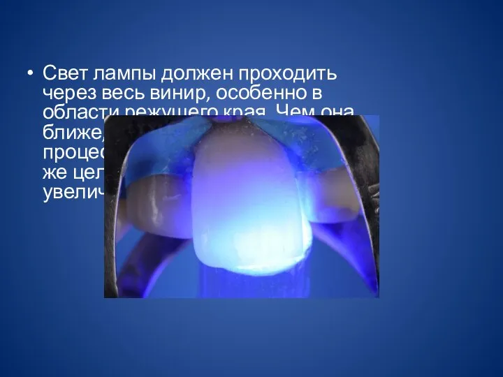 Свет лампы должен проходить через весь винир, особенно в области режущего