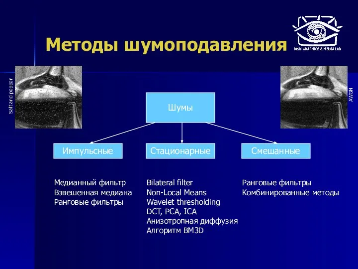 Методы шумоподавления Шумы Стационарные Импульсные Смешанные Медианный фильтр Взвешенная медиана Ранговые