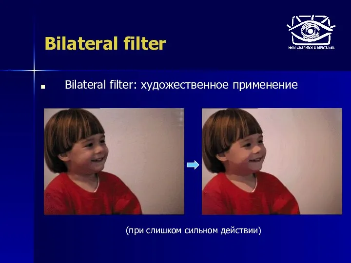 Bilateral filter Bilateral filter: художественное применение (при слишком сильном действии)