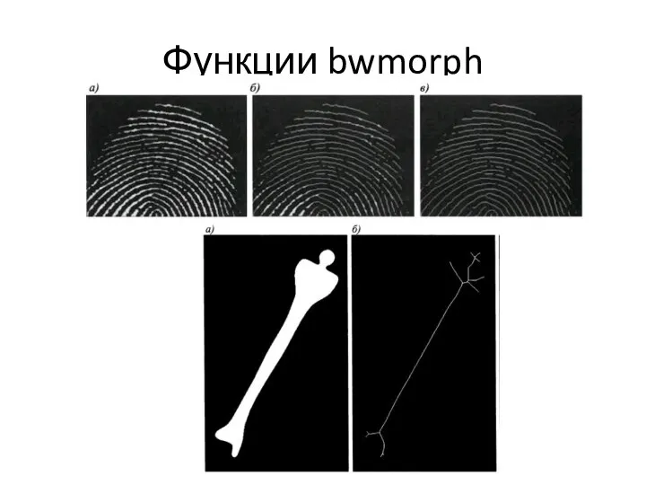 Функции bwmorph