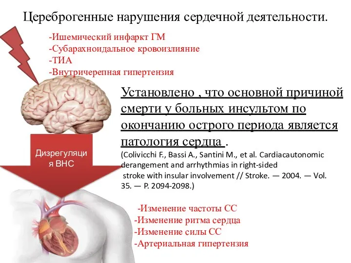 Цереброгенные нарушения сердечной деятельности. -Ишемический инфаркт ГМ -Субарахноидальное кровоизлияние -ТИА -Внутричерепная