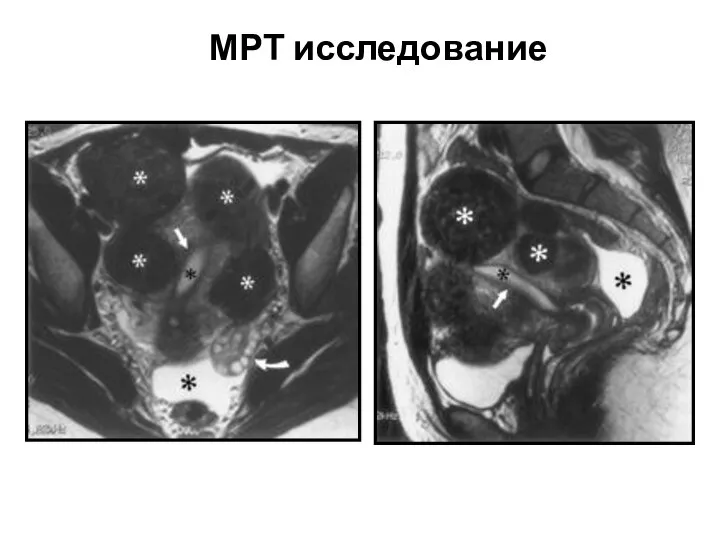 МРТ исследование