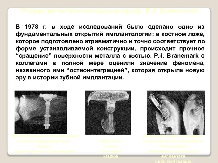 Открытие остеоинтеграции проф. P.-I. Branemark В 1978 г. в ходе исследований