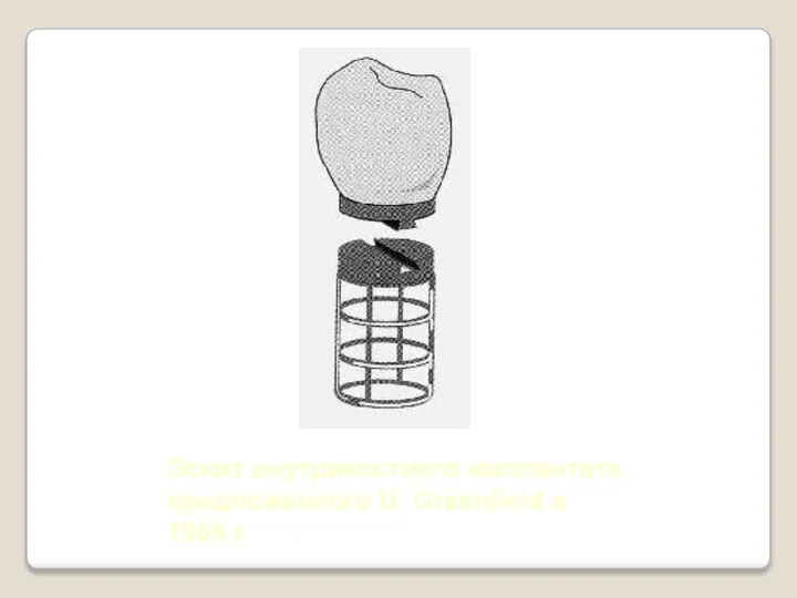 Эскиз внутрикостного имплантата, предложенного U. Greenfield в 1909 г.