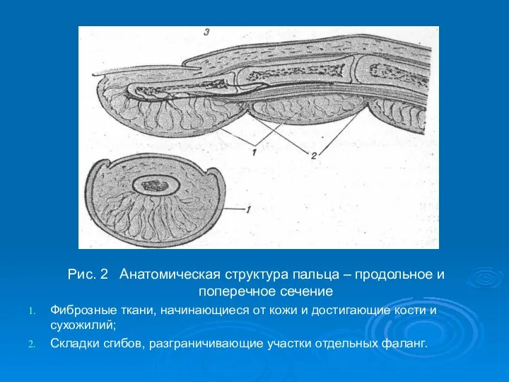 Рис. 2 Анатомическая структура пальца – продольное и поперечное сечение Фиброзные