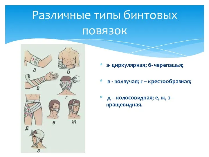 а- циркулярная; б- черепашья; в - ползучая; г – крестообразная; д