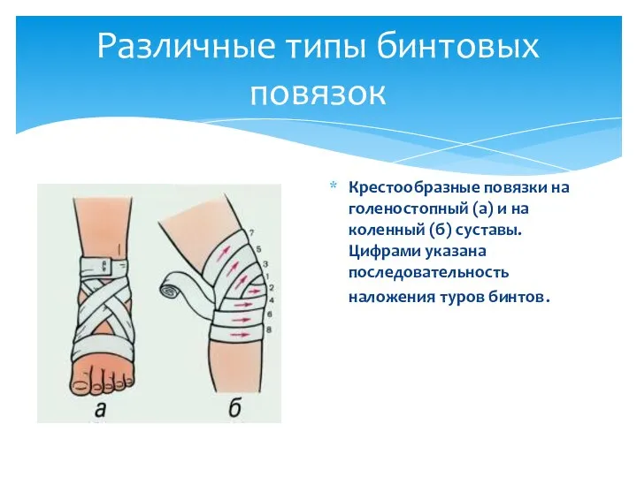 Крестообразные повязки на голеностопный (а) и на коленный (б) суставы. Цифрами