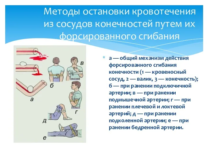 а — общий механизм действия форсированного сгибания конечности (1 — кровеносный