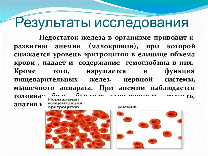 Результаты исследования Недостаток железа в организме приводит к развитию анемии (малокровии),