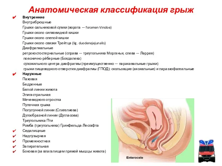 Анатомическая классификация грыж Внутренние Внутрибрюшные Грыжи сальниковой сумки (ворота — foramen