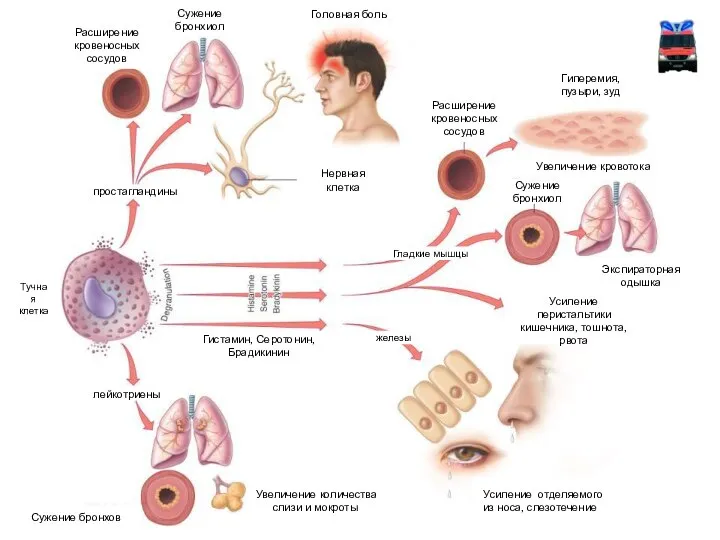 простагландины Расширение кровеносных сосудов Сужение бронхиол Нервная клетка Головная боль Расширение