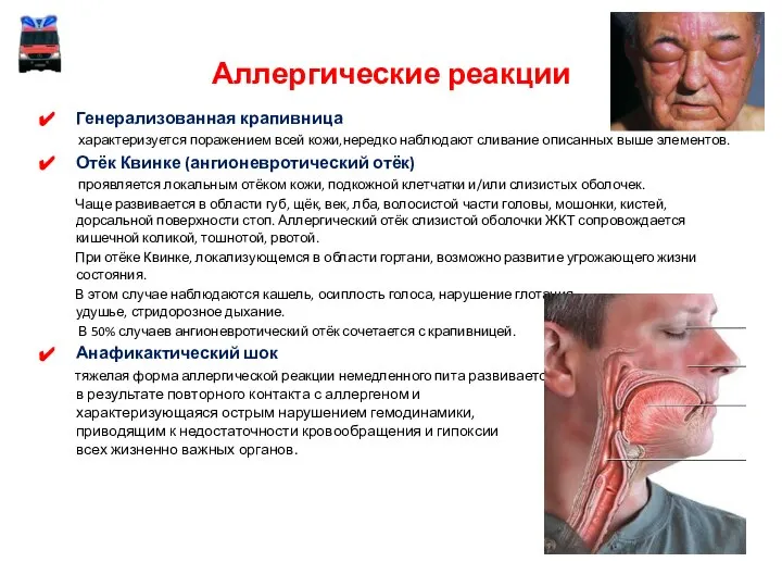 Аллергические реакции Генерализованная крапивница характеризуется поражением всей кожи,нередко наблюдают сливание описанных