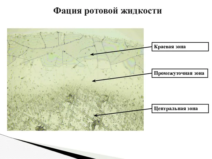 Краевая зона Промежуточная зона Центральная зона Фация ротовой жидкости