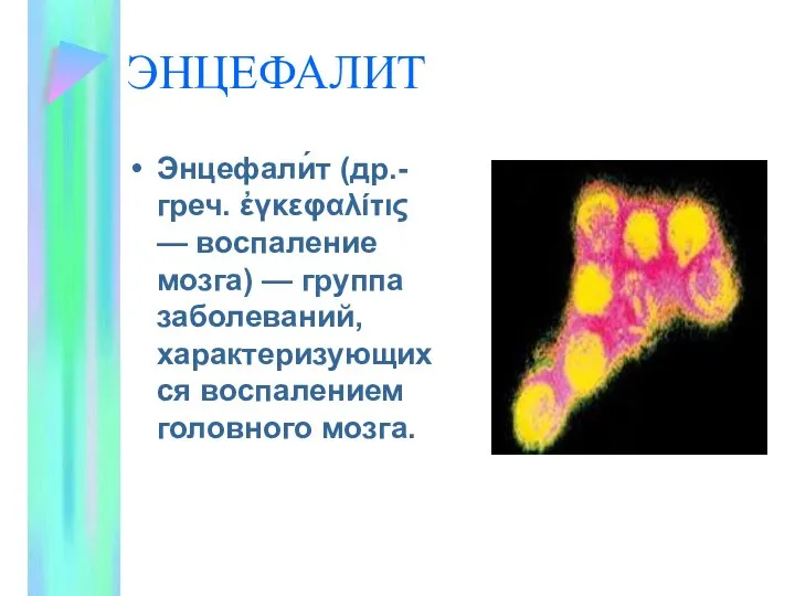 ЭНЦЕФАЛИТ Энцефали́т (др.-греч. ἐγκεφαλίτις — воспаление мозга) — группа заболеваний, характеризующихся воспалением головного мозга.