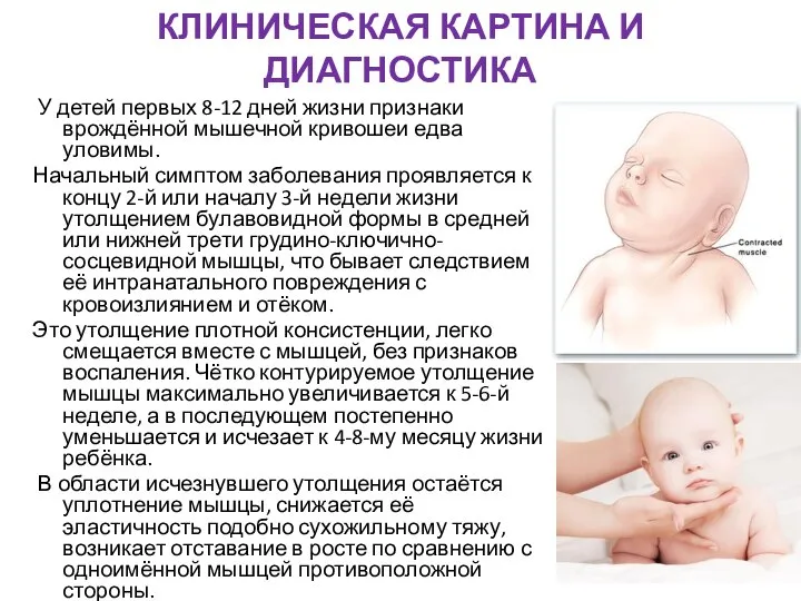 КЛИНИЧЕСКАЯ КАРТИНА И ДИАГНОСТИКА У детей первых 8-12 дней жизни признаки