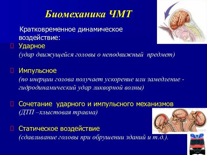 Биомеханика ЧМТ Кратковременное динамическое воздействие: Ударное (удар движущейся головы о неподвижный