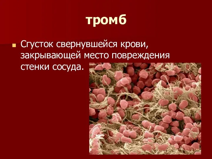 тромб Сгусток свернувшейся крови, закрывающей место повреждения стенки сосуда.