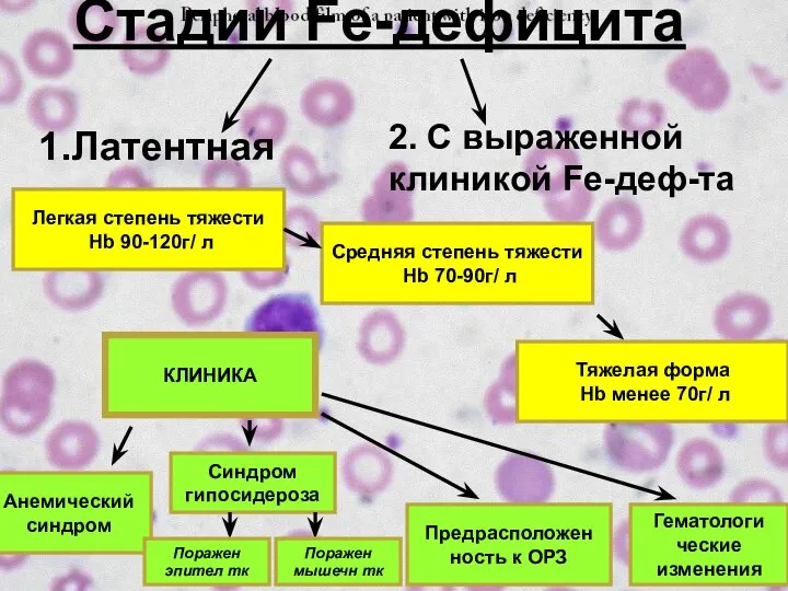 Стадии Fe-дефицита 1.Латентная 2. С выраженной клиникой Fe-деф-та Легкая степень тяжести