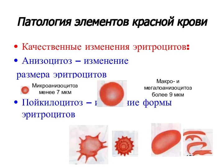 Патология элементов красной крови Качественные изменения эритроцитов: Анизоцитоз – изменение размера
