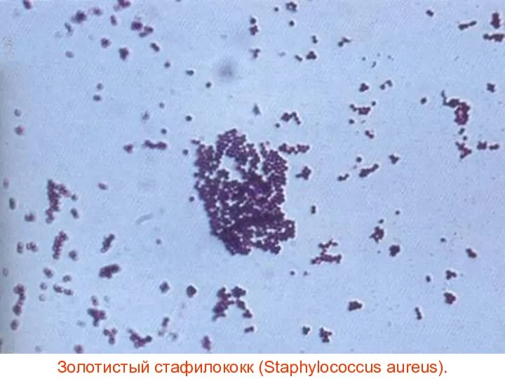 Золотистый стафилококк (Staphylococcus aureus).
