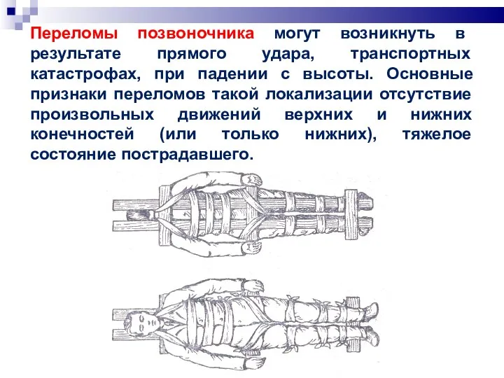 Переломы позвоночника могут возникнуть в результате прямого удара, транспортных катастрофах, при