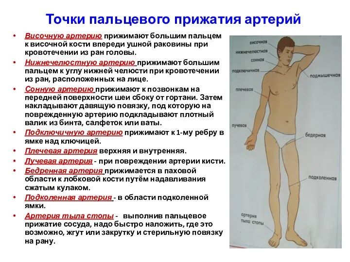 Точки пальцевого прижатия артерий Височную артерию прижимают большим пальцем к височной