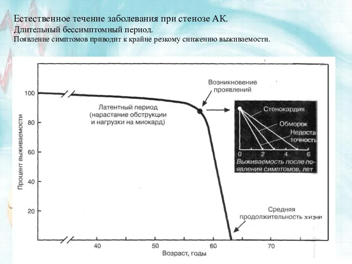 Естественное течение заболевания при стенозе АК. Длительный бессимптомный период. Появление симптомов