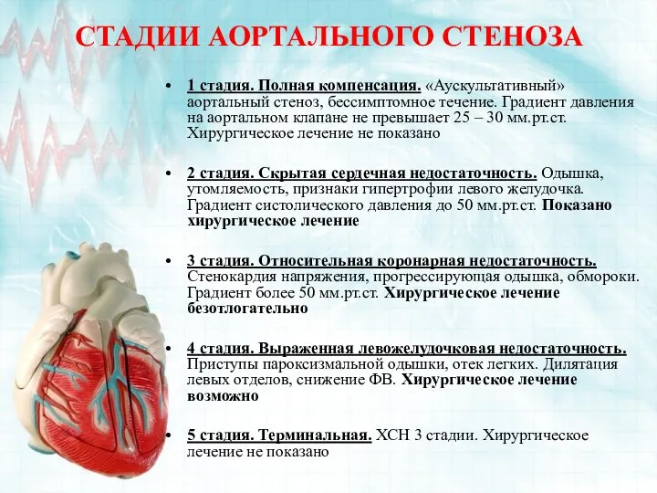 СТАДИИ АОРТАЛЬНОГО СТЕНОЗА 1 стадия. Полная компенсация. «Аускультативный» аортальный стеноз, бессимптомное