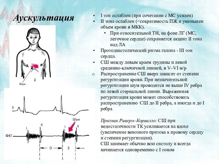 Аускультация I тон ослаблен (при сочетании с МС усилен) II тона