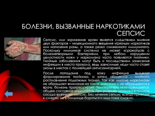 БОЛЕЗНИ, ВЫЗВАННЫЕ НАРКОТИКАМИ СЕПСИС Сепсис, или заражение крови является следствием влияния