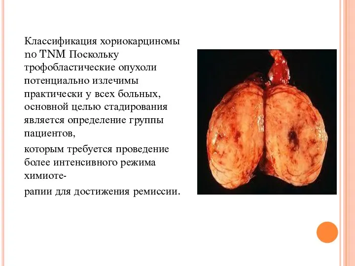 Классификация хориокарциномы no TNM Поскольку трофобластические опухоли потенциально излечимы практически у