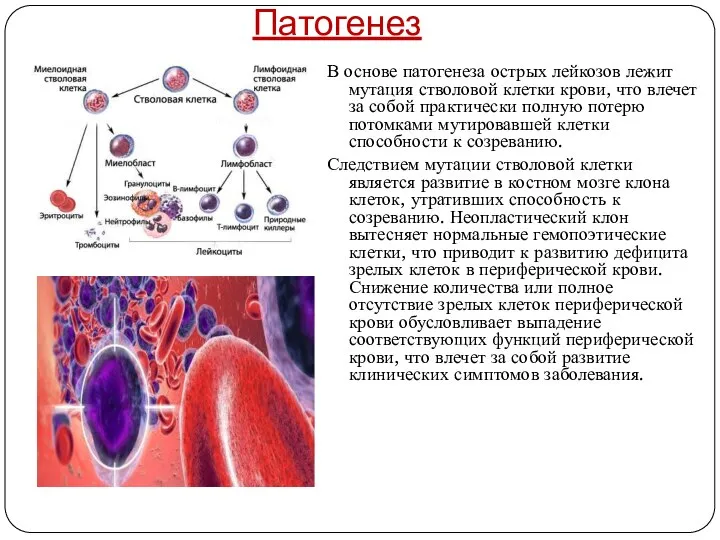 Патогенез В основе патогенеза острых лейкозов лежит мутация стволовой клетки крови,
