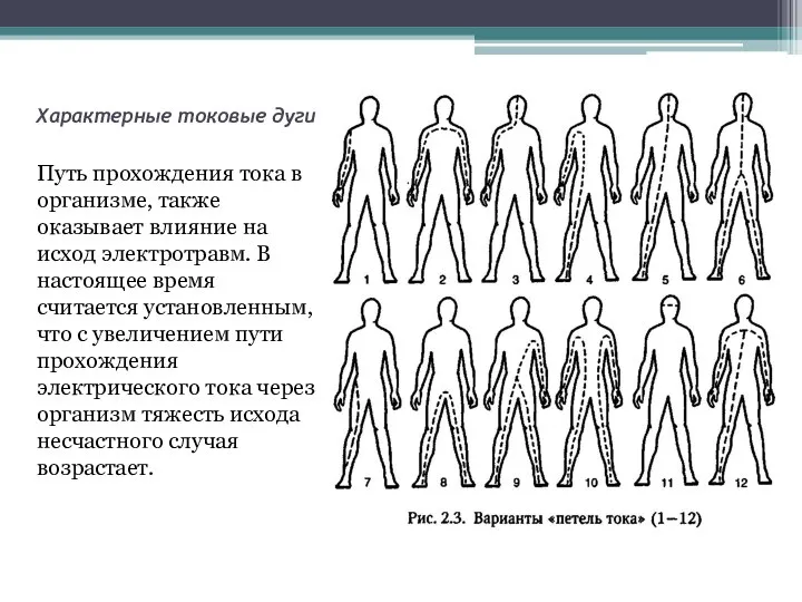 Характерные токовые дуги Путь прохождения тока в организме, также оказывает влияние