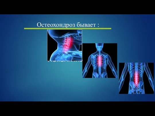 Остеохондроз бывает : Шейный Грудной Поясничный