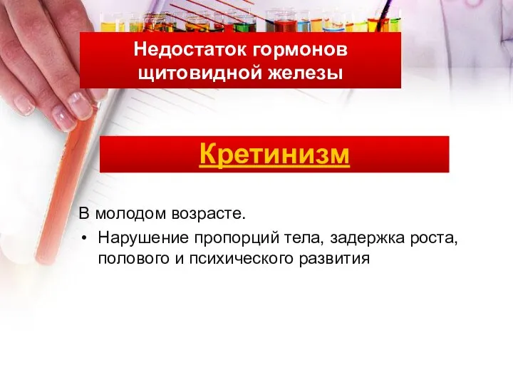 Недостаток гормонов щитовидной железы Кретинизм В молодом возрасте. Нарушение пропорций тела,