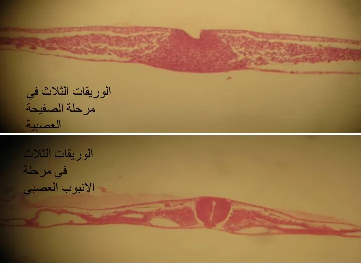 الوريقات الثلاث في مرحلة الصفيحة العصبية الوريقات الثلاث في مرحلة الانبوب العصبي