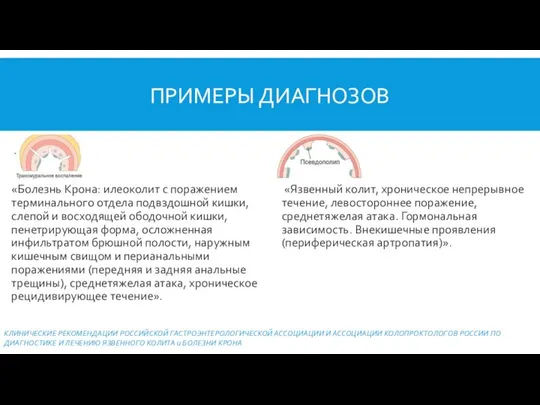 ПРИМЕРЫ ДИАГНОЗОВ «Язвенный колит, хроническое непрерывное течение, левостороннее поражение, среднетяжелая атака.