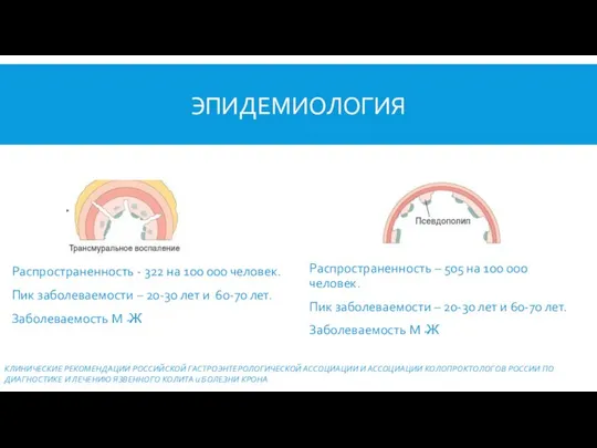 ЭПИДЕМИОЛОГИЯ Распространенность - 322 на 100 000 человек. Пик заболеваемости –